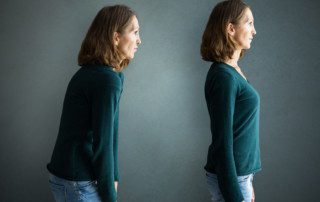 Before and after slim body back pain posture training by a chiropractor